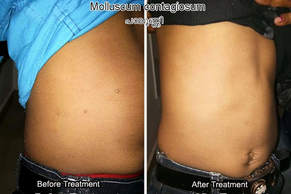 www.poomanamclinic.com