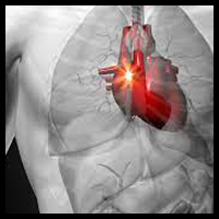 Heart problems